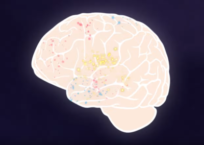 Childhood Trauma and the Brain (video)